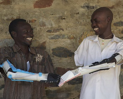 Project Daniel 3D Printed Prosthetics